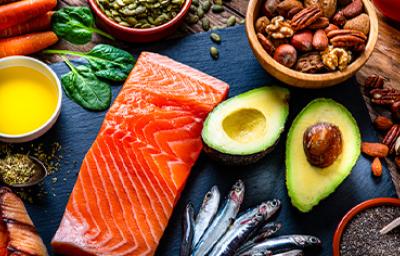 Aceite, salmón, aguacate, entre otras fuentes alimenticias de los diversos tipos de grasas Aceite, salmón, aguacate, entre otras fuentes alimenticias de los diversos tipos de grasas
